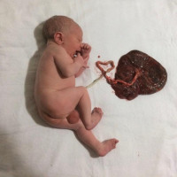 O nascimento do Ravi Cristal